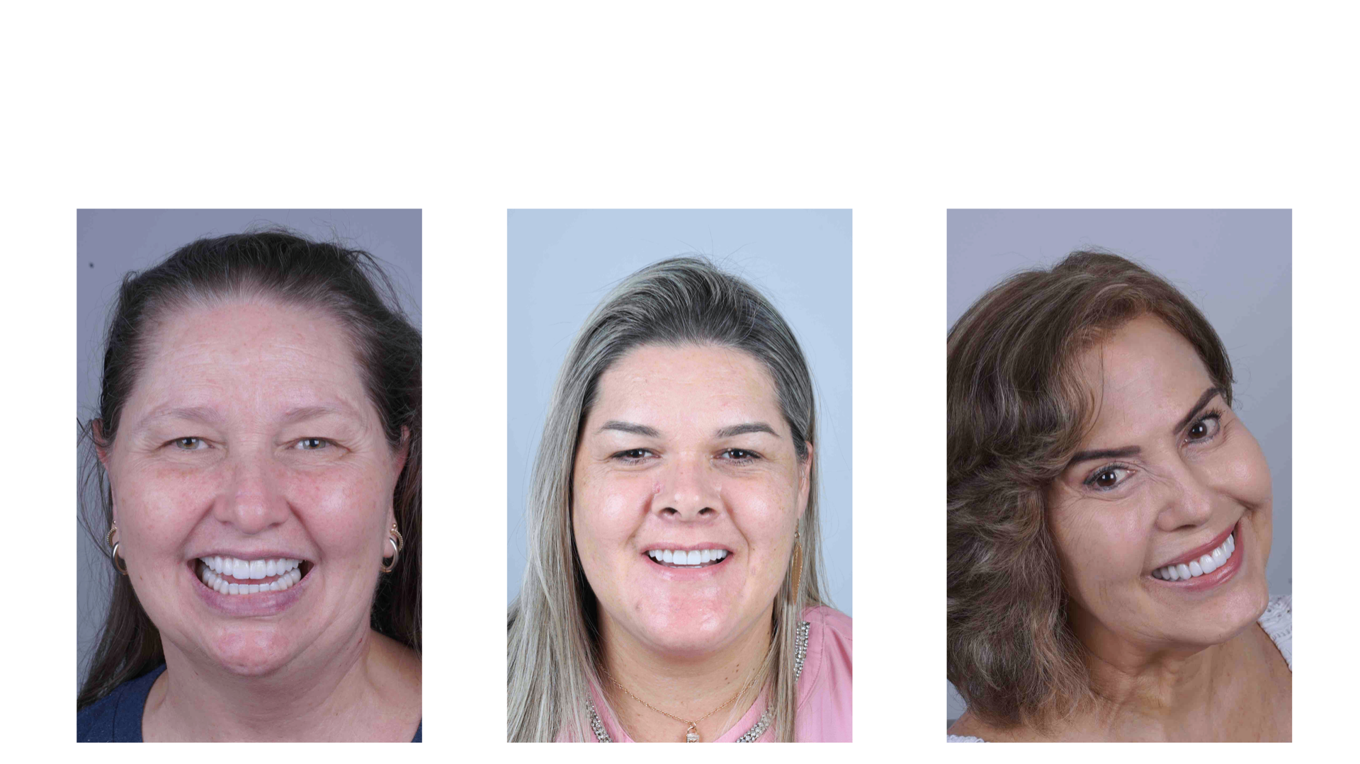 Paciente com dentes perfeitos 2