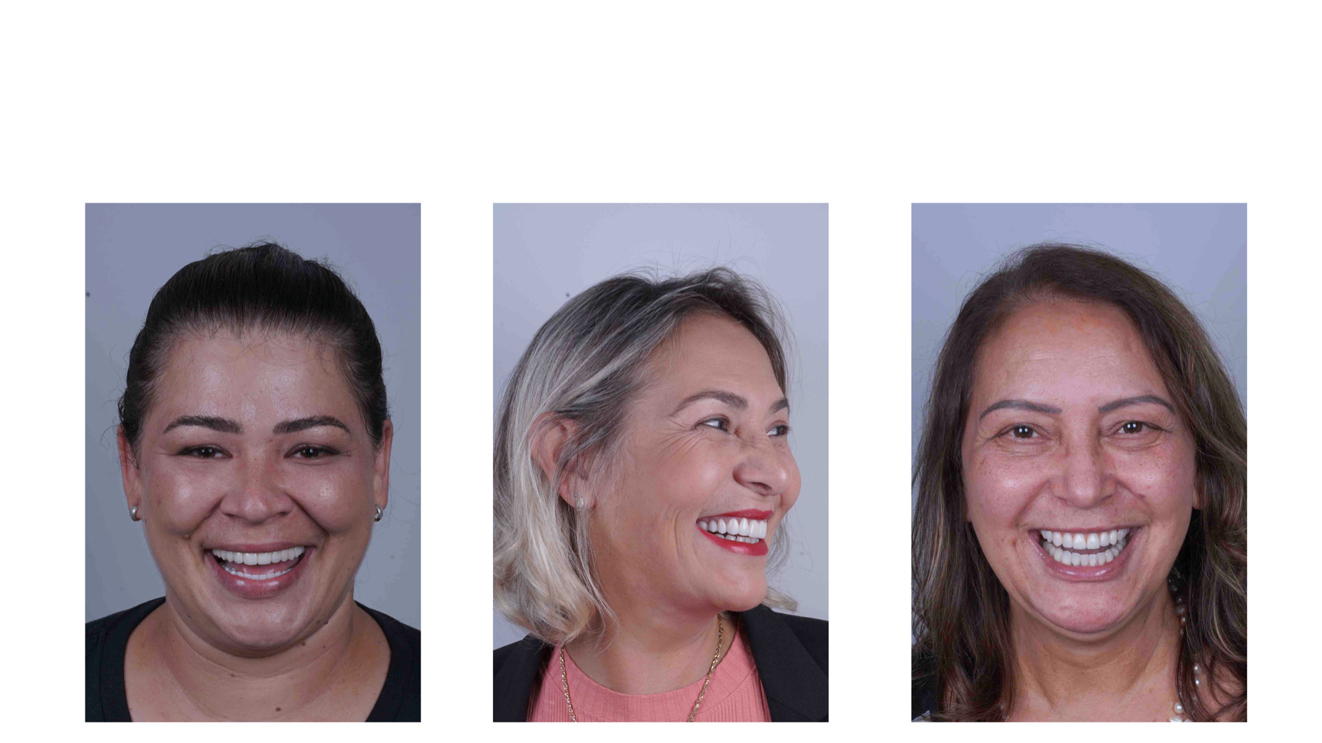 Paciente com dentes perfeitos 1